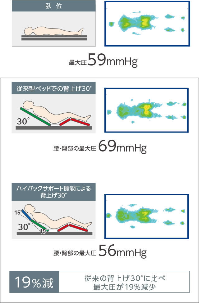 海外販売× アーデル 2M連動HB 木製宮付 Lブラウン P400-62CM 4輪ロック プラッツ 取寄品 JAN 4539940010047 介護福祉用 通販 ★ポイント最大16倍★-アーデル 2M連動HB 木製宮付 Lブラウン P400-62CM 4輪ロック プラッツ JAN 4539940010047 kt405517 取寄品 ベッド関連 ベッド 2モーター-