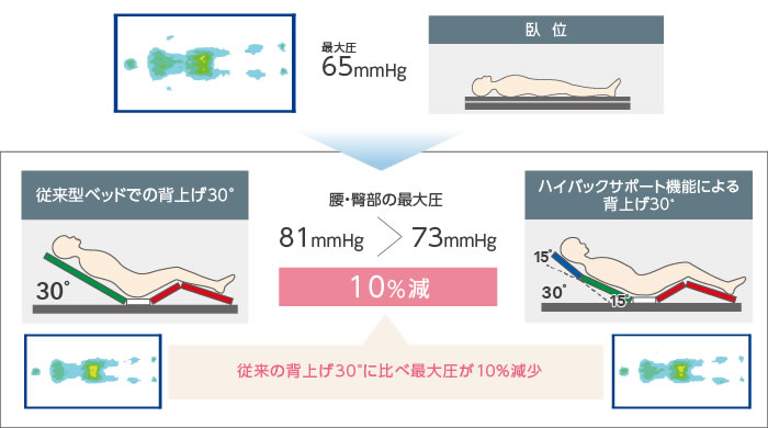 背上げ30°の場合